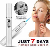Blue Light Acne Pen – Spot Treatment for Breakouts