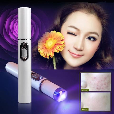 Blue Light Acne Pen – Spot Treatment for Breakouts